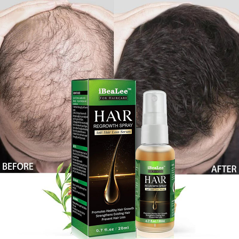 Ginger Hair Growth Spray 20ml Regrowth & Stop Hair Loss by iBeaLee, NEW